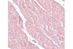 Immunohistochemistry of mouse heart tissue with C12orf44 polyclonal antibody  at 5 ug/mL. (ATG101 anticorps  (Internal Region))