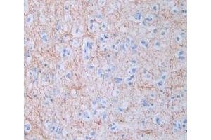 DAB staining on IHC-P; Samples: Human Brain Tissue (Amphiregulin anticorps  (AA 20-100))