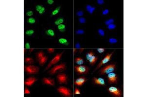Immunofluorescence of Histone H3 [ac Lys9/phosphor Ser10]: Histone H3 K9-Ac/pS10 antibody was tested in HeLa cells with DyLight 488 (green). (Histone 3 anticorps  (H3K9ac, pSer10))
