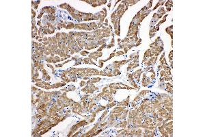 Anti-cardiac Troponin C antibody, IHC(P) IHC(P): Rat Cardiac Muscle Tissue