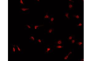 ABIN6268972 staining K-562 cells by IF/ICC. (Cyclin H anticorps  (pThr315))