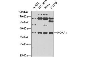 Western blot analysis of extracts of various cell lines, using HOX antibody (ABIN6131766, ABIN6141930, ABIN6141931 and ABIN6222663) at 1:1000 dilution. (HOXA1 anticorps  (AA 75-205))