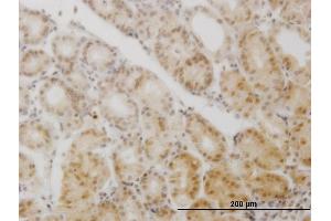 Immunoperoxidase of monoclonal antibody to GCM1 on formalin-fixed paraffin-embedded human stomach.