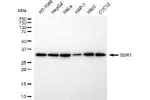 anti-Signal Sequence Receptor, alpha (SSR1) antibody