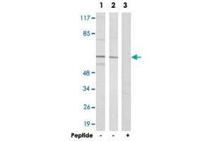 Western blot analysis of extracts from Jurkat (Lane 1 and lane 3) cells and A-549 (Lane 2) cells, using SLC43A1 polyclonal antibody . (SLC43A1 anticorps)