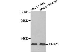 Western blot analysis of extracts of various cell lines, using FABP5 antibody. (FABP5 anticorps  (AA 1-135))