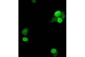 Anti-UBE2T mouse monoclonal antibody (ABIN2453760) immunofluorescent staining of COS7 cells transiently transfected by pCMV6-ENTRY UBE2T (RC200748). (Ube2t anticorps)