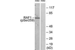 Western blot analysis of extracts from K562 cells, using C-RAF (Phospho-Ser259) Antibody. (RAF1 anticorps  (AA 225-274))