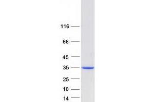 Validation with Western Blot