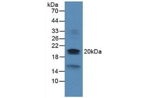 Detection of DUSP3 in Rat Heart Tissue using Monoclonal Antibody to Dual Specificity Phosphatase 3 (DUSP3) (Dual Specificity Phosphatase 3 (DUSP3) (AA 2-185) anticorps)