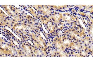 Detection of MMP3 in Rat Kidney Tissue using Polyclonal Antibody to Matrix Metalloproteinase 3 (MMP3)