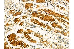 anti-Oral-Facial-Digital Syndrome 1 (OFD1) (Internal Region) antibody