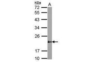 Image no. 1 for anti-Cysteine and Glycine-Rich Protein 2 (CSRP2) (AA 10-193) antibody (ABIN1497665) (CSRP2 anticorps  (AA 10-193))