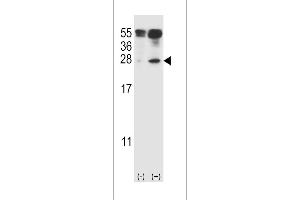 Western blot analysis of IL27 (arrow) using rabbit polyclonal IL27 Antibody (C71) (ABIN388443 and ABIN2848726). (IL-27 anticorps  (AA 57-87))