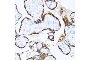 Immunohistochemistry of paraffin-embedded human placenta using Casein Kinase 1 alpha (Casein Kinase 1 alpha (CSNK1)) antibody (6225) at dilution of 1:100 (40x lens). (CSNK1A1 anticorps  (AA 100-200))