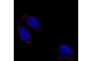 Image no. 2 for anti-POU Class 5 Homeobox 1 (POU5F1) (N-Term) antibody (ABIN357427) (OCT4 anticorps  (N-Term))