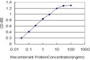 Detection limit for recombinant GST tagged CACNB2 is approximately 0.