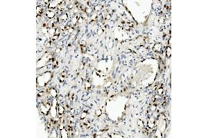 IHC analysis of NOVA2 using anti-NOVA2 antibody (ABIN7599078). (NOVA2 anticorps  (AA 1-205))