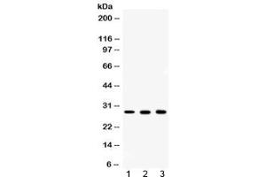Western blot testing of 1) rat ovary, 2) mouse liver and 3) human MCF7 lysate with CA2 antibody at 0.