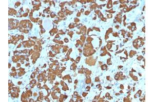 Formalin-fixed, paraffin-embedded human Pituitary stained with Growth Hormone Monoclonal Antibody (SPM106). (Growth Hormone 1 anticorps  (AA 58-187))