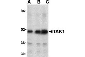 Western Blotting (WB) image for anti-Nuclear Receptor Subfamily 2, Group C, Member 2 (NR2C2) (N-Term) antibody (ABIN1031601) (TR4 anticorps  (N-Term))