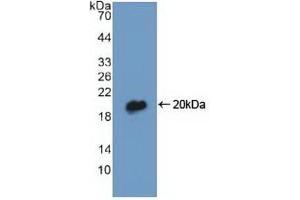 Detection of Recombinant DBI, Human using Polyclonal Antibody to Diazepam Binding Inhibitor (DBI)