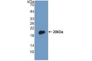 Detection of Recombinant DBI, Human using Polyclonal Antibody to Diazepam Binding Inhibitor (DBI) (Diazepam Binding Inhibitor anticorps  (AA 1-104))