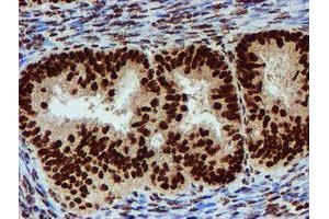 Image no. 1 for anti-Peptidyl Arginine Deiminase, Type IV (PADI4) antibody (ABIN1500017)