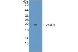 Detection of Recombinant KRT9, Human using Monoclonal Antibody to Cytokeratin 9 (CK9) (KRT9 anticorps  (AA 315-456))