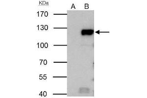 IP Image Rb antibody immunoprecipitates retinoblastoma 1 protein in IP experiments.