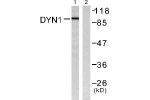 Western blot analysis of extracts from mouse brain, using Dynamin-1 (Ab-774) Antibody (#B0422).