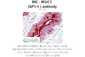 Image no. 1 for anti-Mucin 1 (MUC1) antibody (ABIN1724386) (MUC1 anticorps)