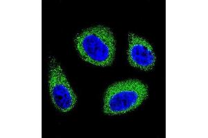 Immunofluorescence (IF) image for anti-7-Dehydrocholesterol Reductase (DHCR7) antibody (ABIN2996203) (DHCR7 anticorps)