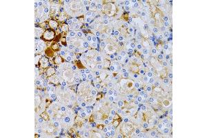 Immunohistochemistry of paraffin-embedded rat kidney using TFF1/pS2 antibody (ABIN3015565, ABIN3015566, ABIN3015567 and ABIN6218896) at dilution of 1:200 (40x lens).