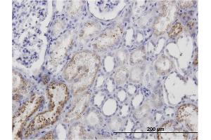 Immunoperoxidase of monoclonal antibody to AMBP on formalin-fixed paraffin-embedded human kidney. (AMBP anticorps)