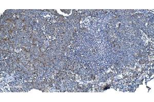IHC analysis of DRP1/DNM1L using anti-DRP1/DNM1L antibody (ABIN7602180). (Dynamin 1-Like anticorps  (AA 618-736))