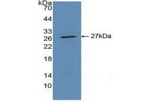 Detection of Recombinant CLEC10A, Mouse using Polyclonal Antibody to Cluster Of differentiation 301 (CD301) (CLEC10A anticorps  (AA 69-273))
