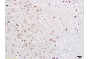 Formalin-fixed and rat brain tissue labeled with Anti-Midnolin Polyclonal Antibody, Unconjugated  1:200 followed by conjugation to the secondary antibody and DAB staining (MIDN anticorps  (AA 51-150))