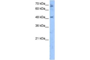 Western Blotting (WB) image for anti-Membrane Bound O-Acyltransferase Domain Containing 7 (MBOAT7) antibody (ABIN2463293)