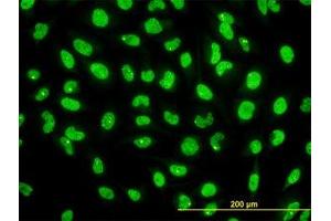 Image no. 2 for anti-serine/threonine Kinase 38 (STK38) (AA 1-466) antibody (ABIN599179) (STK38 anticorps  (AA 1-466))