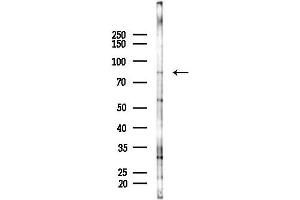 Western blot analysis of lysates from A2780 cells(starvation 24h treatment), using SEMA3C Antibody at 1/1000 dilution.