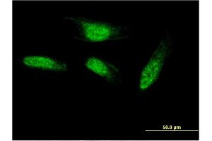 Immunofluorescence of monoclonal antibody to SEC14L2 on HeLa cell. (SEC14L2 anticorps  (AA 101-199))
