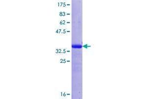 Image no. 1 for Follistatin-Like 1 (FSTL1) (AA 209-306) protein (GST tag) (ABIN1354465)