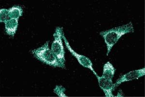 Immunofluorescence staining of HeLa cells (Human cervical epitheloid carcinoma, ATCC CCL-2. (ITGB1 anticorps  (AA 76-256))