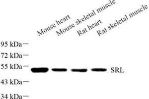 Western blot analysis of Srl (ABIN7075508) at dilution of 1: 500 (Sarcalumenin anticorps)