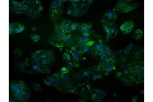 Immunofluorescent staining of HepG2 cells using anti-ALDH2 mouse monoclonal antibody (ABIN2452752). (ALDH2 anticorps)
