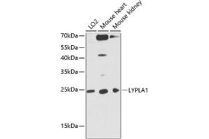 Western blot analysis of extracts of various cell lines, using LYPL antibody (ABIN1680728, ABIN3018907, ABIN3018908 and ABIN6220622) at 1:3000 dilution. (LYPLA1 anticorps  (AA 1-230))