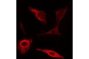 anti-Peroxiredoxin 2 (PRDX2) (C-Term) antibody