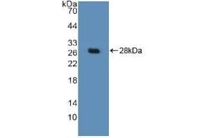 Detection of Recombinant DDB2, Human using Polyclonal Antibody to Damage Specific DNA Binding Protein 2 (DDB2) (DDB2 anticorps  (AA 166-383))