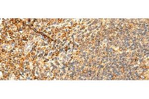 Immunohistochemistry of paraffin-embedded Human tonsil tissue using PPM1B Polyclonal Antibody at dilution of 1:50(x200) (PPM1B anticorps)